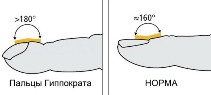 Барабанные палочки - ногти