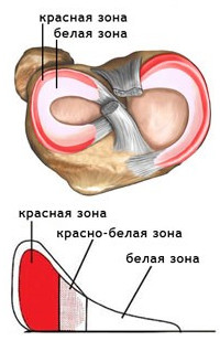 Артроскопический шов мениска коленного сустава зоны